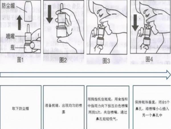 過敏性鼻炎，常用糠酸莫米松鼻噴、孟魯司特、氯雷他定要注意啥？