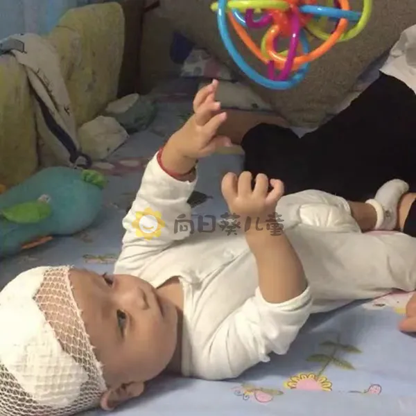 4個月腦瘤嬰兒半年開顱5次 90後新手父母帶兒披荊斬棘