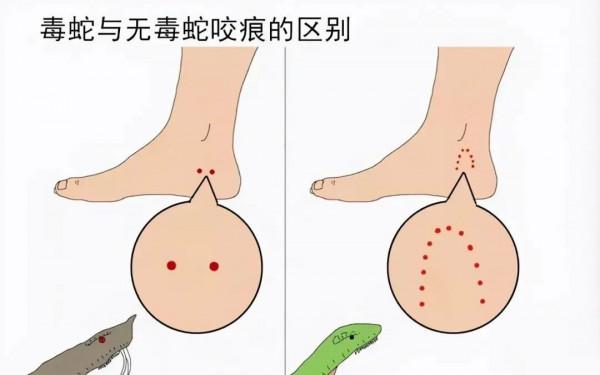 死蛇也會咬人!被打死的蛇“復活”傷人,是科學還是迷信? 死蛇也會咬人!被打死的蛇“復活”傷人,是科學還是迷信?