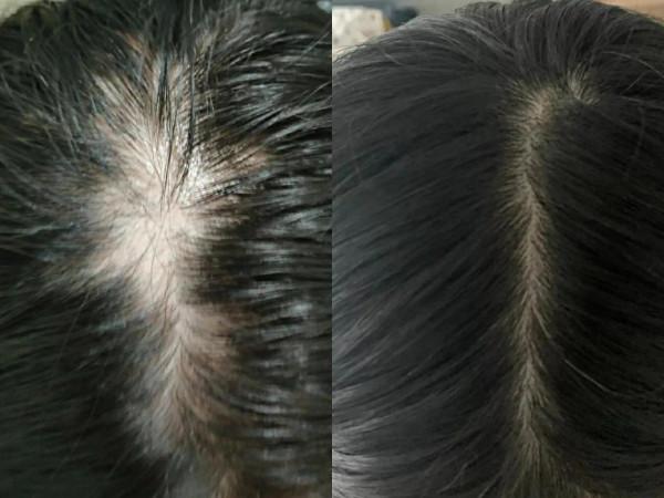 6種“買得起”護膚品,別嫌棄它們是小眾品牌,效果不輸大牌 6種“買得起”護膚品,別嫌棄它們是小眾品牌,效果不輸大牌