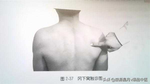 肩部疼痛的觸診圖解（很珍貴資料），值得一看
