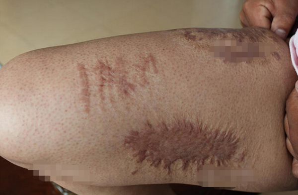 2003年工人挖出5個日軍遺留鐵桶，致1死43中毒，日本賠了多少錢？