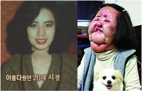 被整容毀了的7位明星，雖各有各的苦衷，卻都美麗盡失、事業滑坡