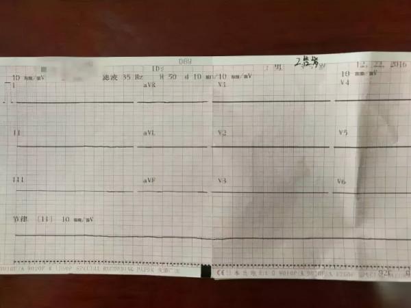 女士只是心慌30分鐘,做完心電圖後,為啥心臟專家說:九死一生 女士只是心慌30分鐘,做完心電圖後,為啥心臟專家說:九死一生