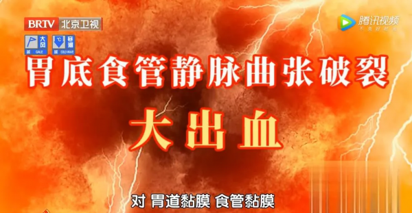 四個異常症狀,是肝在求救!專家推薦一個飲食方法,幫您保肝護肝 四個異常症狀,是肝在求救!專家推薦一個飲食方法,幫您保肝護肝