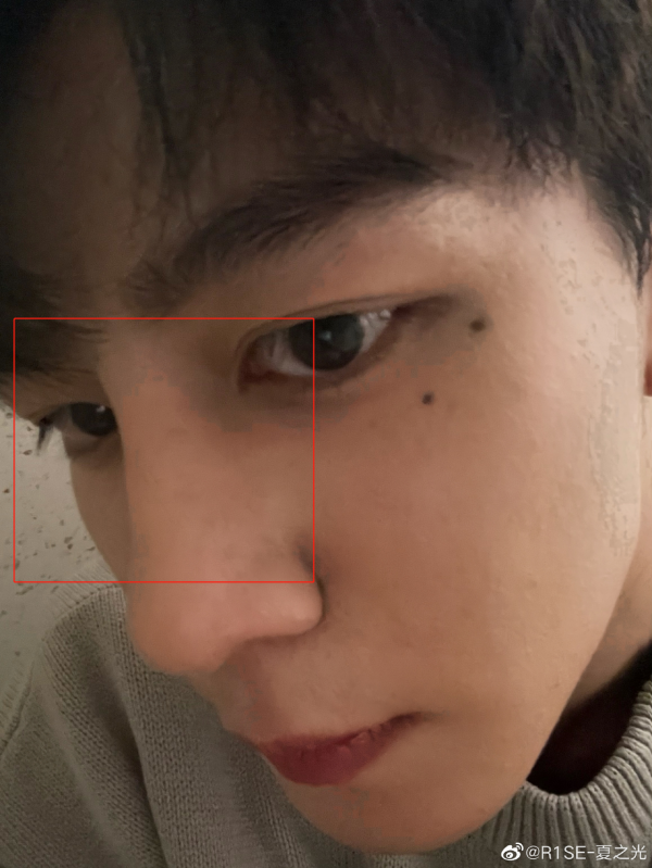 整容後遺症?都說帥卻看來非常“奇怪”的8個男星,各有各的怪法 整容後遺症?都說帥卻看來非常“奇怪”的8個男星,各有各的怪法