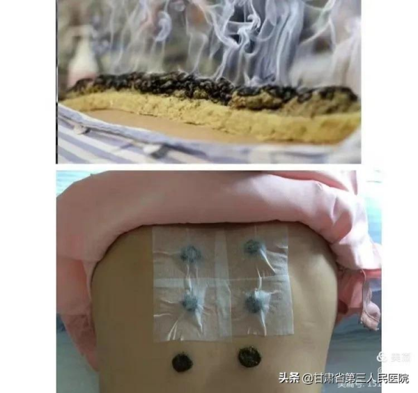 省三院";夏病冬治";、“冬病冬治”開始預約啦 省三院";夏病冬治";、“冬病冬治”開始預約啦