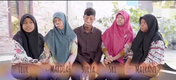 男子一家人患怪病，長得像動物，至今沒有治療方法