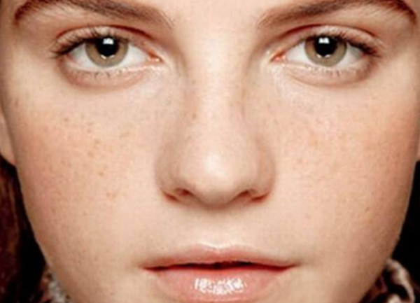 臉上“長斑”怎麼辦?這份“淡斑護膚”指南,請收好 臉上“長斑”怎麼辦?這份“淡斑護膚”指南,請收好