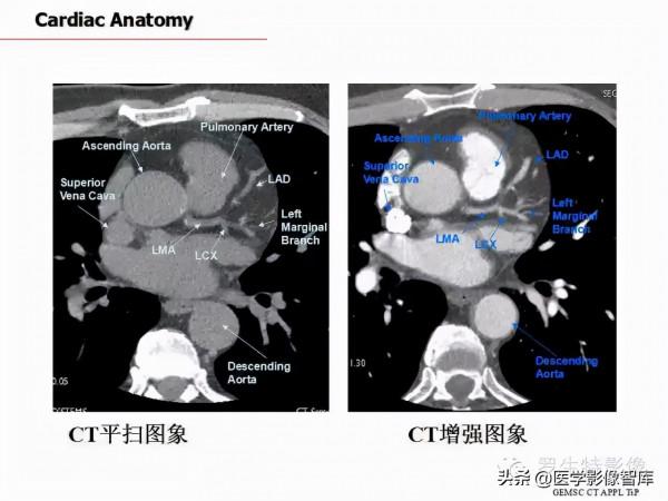 CT斷層解剖圖譜最全總結「推薦收藏」 CT斷層解剖圖譜最全總結「推薦收藏」