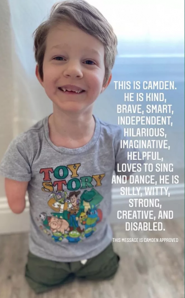 B超嬰兒無四肢,18歲媽媽拒絕墮胎,冒險生子,把孩子養成男子漢 B超嬰兒無四肢,18歲媽媽拒絕墮胎,冒險生子,把孩子養成男子漢