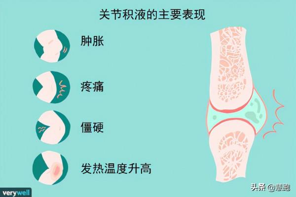 跑步跑出關節積液可怕嗎？有什麼後果？如何解決？