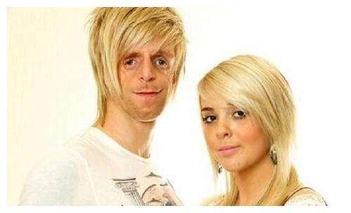 英國男子臉部畸形，憑魅力迎娶美女大學生，孩子出生後笑不出來了