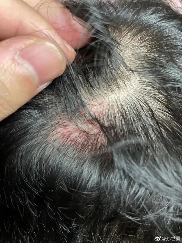 中國留學生在韓遭攻擊，外交部回應