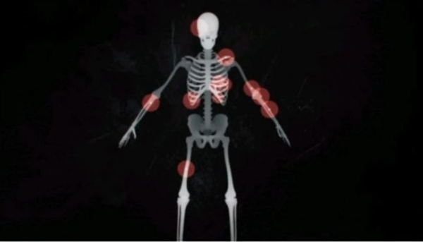 2020年,韓國女童被領養271天后被養父母虐殺,屍檢結果不忍細看 2020年,韓國女童被領養271天后被養父母虐殺,屍檢結果不忍細看