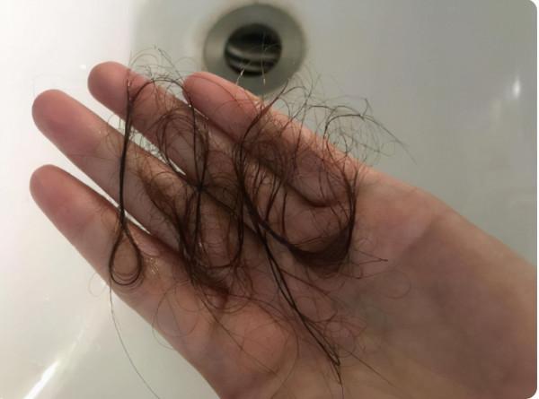 濟南一名43歲女子，每天服用一片葉酸，半年後身體有什麼變化？