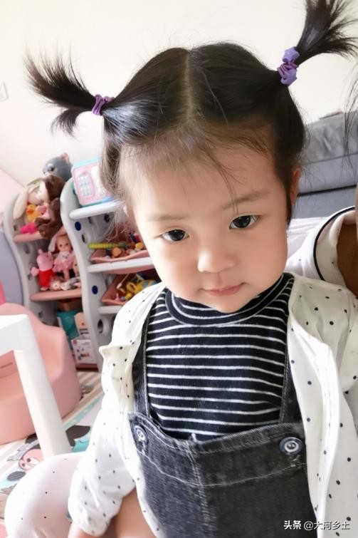 2歲女孩頻繁發燒,病因是體內缺一種細胞,目前已花百萬元治療費 2歲女孩頻繁發燒,病因是體內缺一種細胞,目前已花百萬元治療費