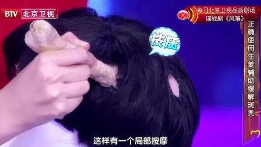 斑禿是什麼原因引起的?該怎麼治療? 斑禿是什麼原因引起的?該怎麼治療?