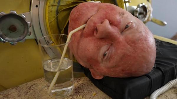 為了活命，男人在鐵桶中一躺就是70年，一生從未離開過鐵桶