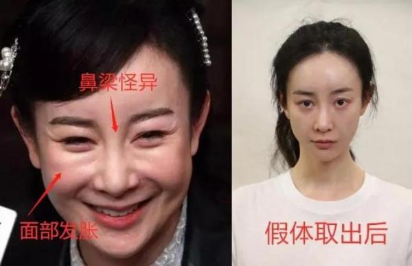 “娛樂圈”的整容臉 “娛樂圈”的整容臉