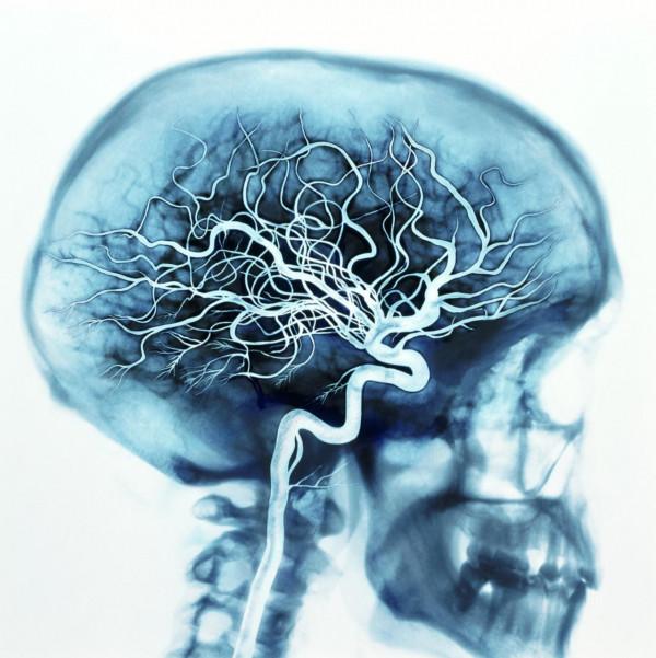 30萬人永無休止的噩夢!1949年的醫學獎:諾貝爾獎史上最大恥辱 30萬人永無休止的噩夢!1949年的醫學獎:諾貝爾獎史上最大恥辱