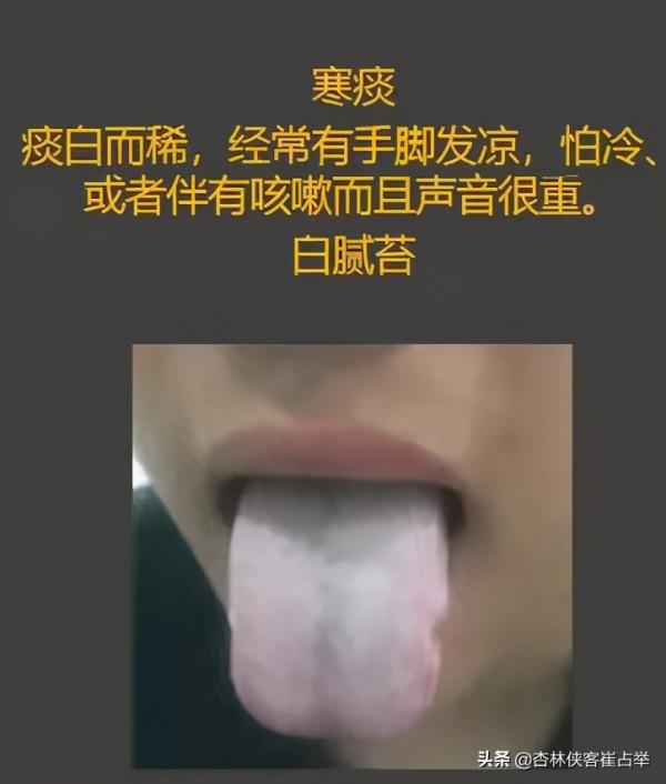 咳白痰、黃痰、清稀泡沫痰，3種情況3種原因，教你一分鐘辨別