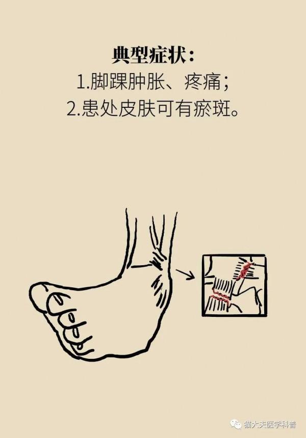 姿勢不對會引起5種損傷！你的跑步姿勢正確嗎？