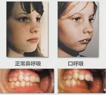 為什麼有的孩子越長越醜了？大多是因為這幾個壞習慣