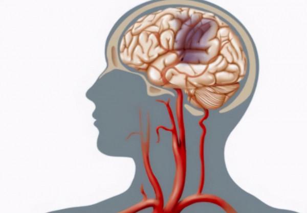 走路時，膝蓋突然“軟”一下，是咋回事？要警惕這幾種情況