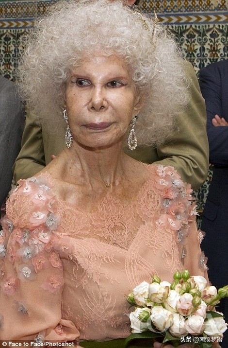 阿爾貝女公爵：整容整成猴，小24歲公務員對她一見鍾情，85歲再婚