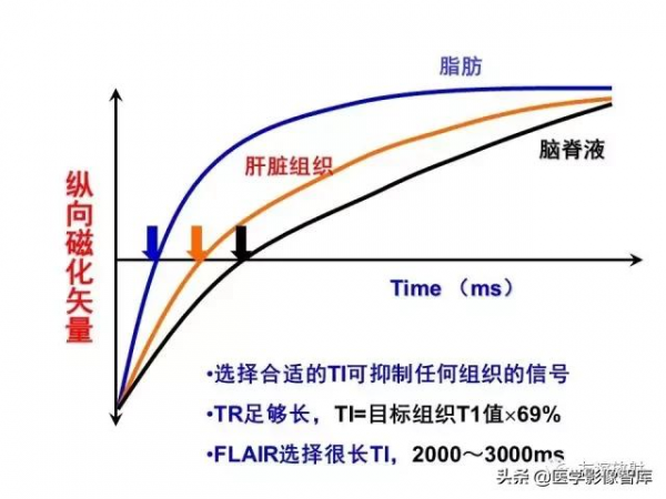 臨床MRI訊號分析基礎：常規序列及DWI序列