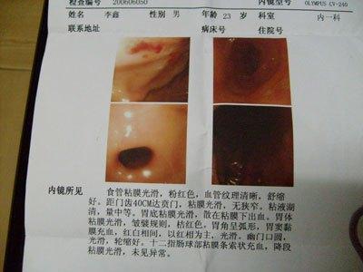 教你如何看胃鏡報告，提醒：報告若出現這3個詞，請提高警惕