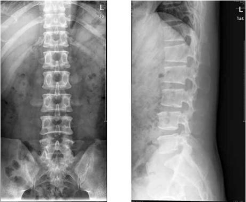 腰疼來就診，在放射科我們需要做哪些檢查？