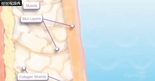 入門級醫美專案指南!美容院不告訴你的,這篇全都有 入門級醫美專案指南!美容院不告訴你的,這篇全都有