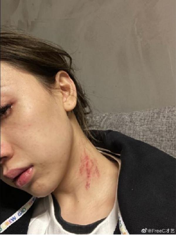 《中國新說唱》女歌手控訴男友歌手“家暴”:戀愛腦沒有好下場 《中國新說唱》女歌手控訴男友歌手“家暴”:戀愛腦沒有好下場