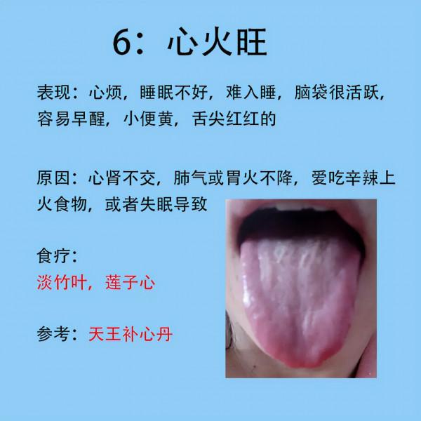 女人常見6種症狀，以及對應舌象和解決的方法分享