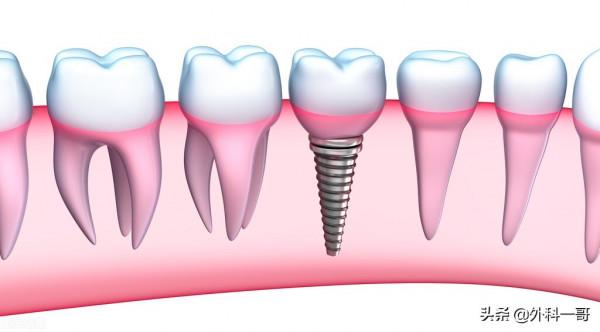 臨床口腔的78個基礎知識點