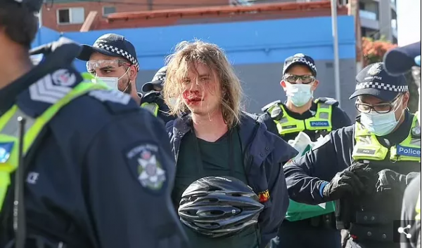 澳大利亞亂了!為反疫苗太瘋狂,抗議者圍攻警察,騎警街頭衝鋒 澳大利亞亂了!為反疫苗太瘋狂,抗議者圍攻警察,騎警街頭衝鋒