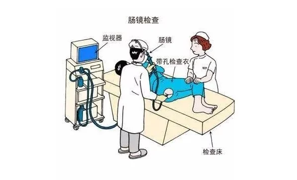 肛腸檢查:你到底在怕什麼 肛腸檢查:你到底在怕什麼