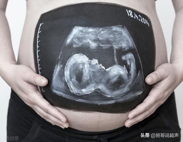 知道為什麼中孕期要做B超嗎？