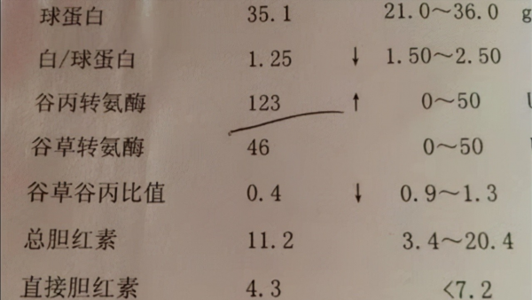 肝功能檢查單怎麼看？醫生：這3個指標正常，說明你的肝臟很健康