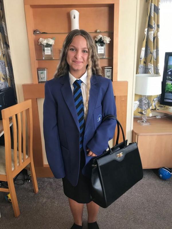 被嘲笑是馴鹿“魯道夫”的英國女孩,脫胎換骨後投身慈善事業 被嘲笑是馴鹿“魯道夫”的英國女孩,脫胎換骨後投身慈善事業