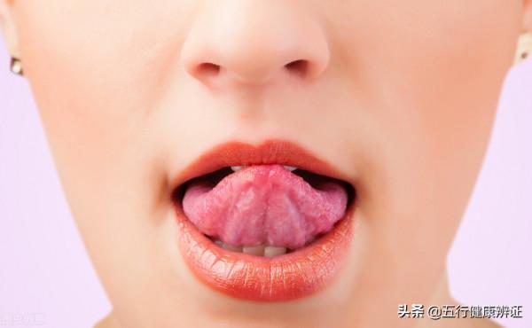 舌尖疼心火旺、舌邊疼肝火旺、舌中疼胃火旺，送你簡單應對方法