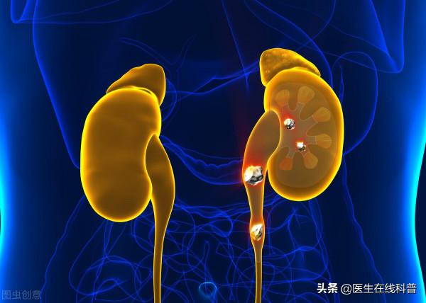 幾味中藥延緩腎病程序，28歲的腎友病情穩定，已經回到正常生活中