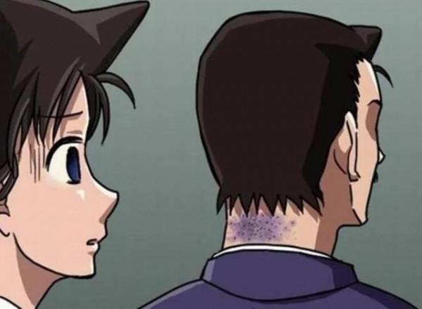 動漫人物的黑歷史，毛利小五郎的脖子還好嗎？卡米爾看了想打人