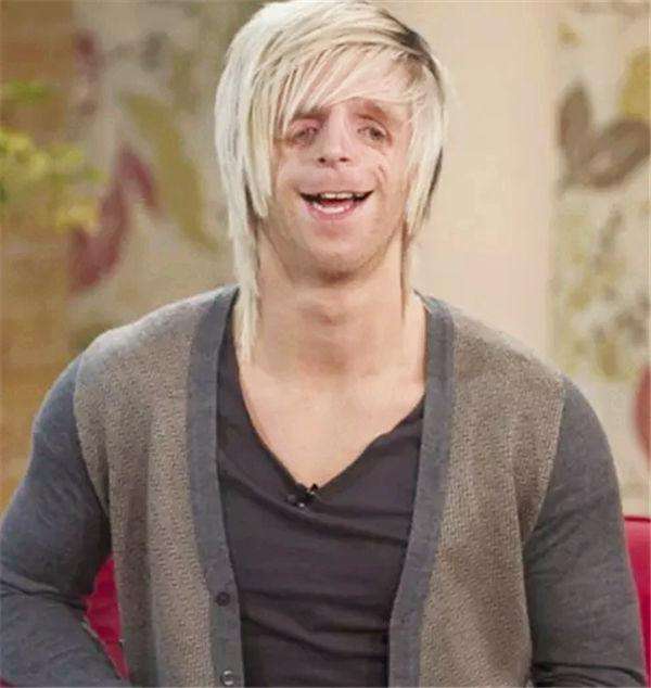 英國男子臉部畸形，憑魅力迎娶美女大學生，孩子出生後笑不出來了