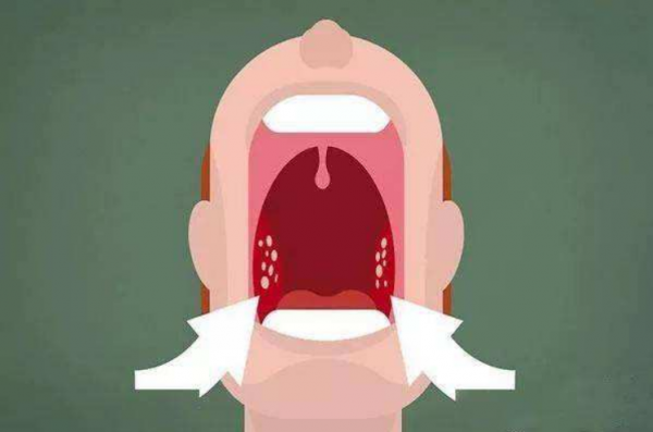 孩子腺樣體肥大,根源在這2處,會產生3大方面危害 孩子腺樣體肥大,根源在這2處,會產生3大方面危害