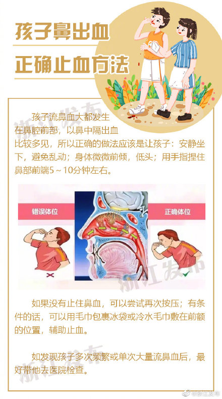 孩子鼻子出血,應該這樣止血 孩子鼻子出血,應該這樣止血