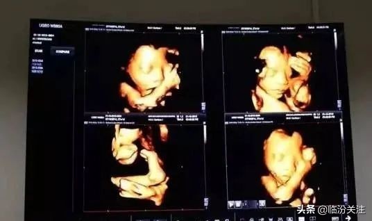 五維彩超到底在哪裡做,看完這篇文章再決定! 五維彩超到底在哪裡做,看完這篇文章再決定!