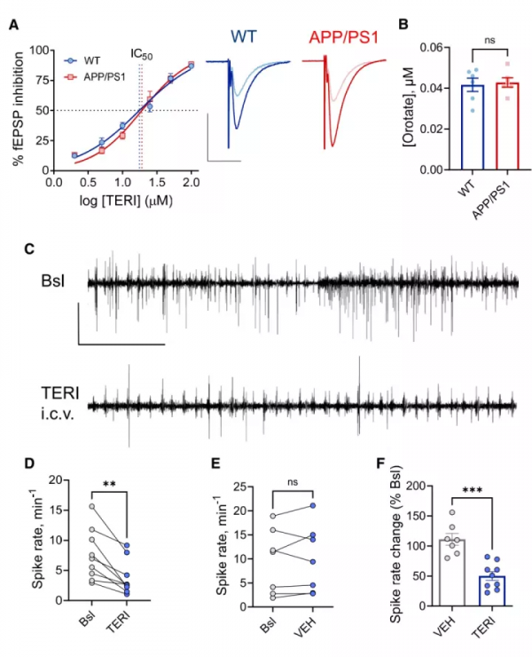 Cell Rep：阿爾茨海默病早期在睡眠時可能存在神經環路功能失調